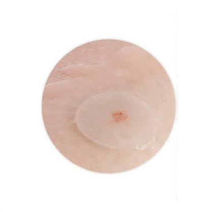 pimple cover patch