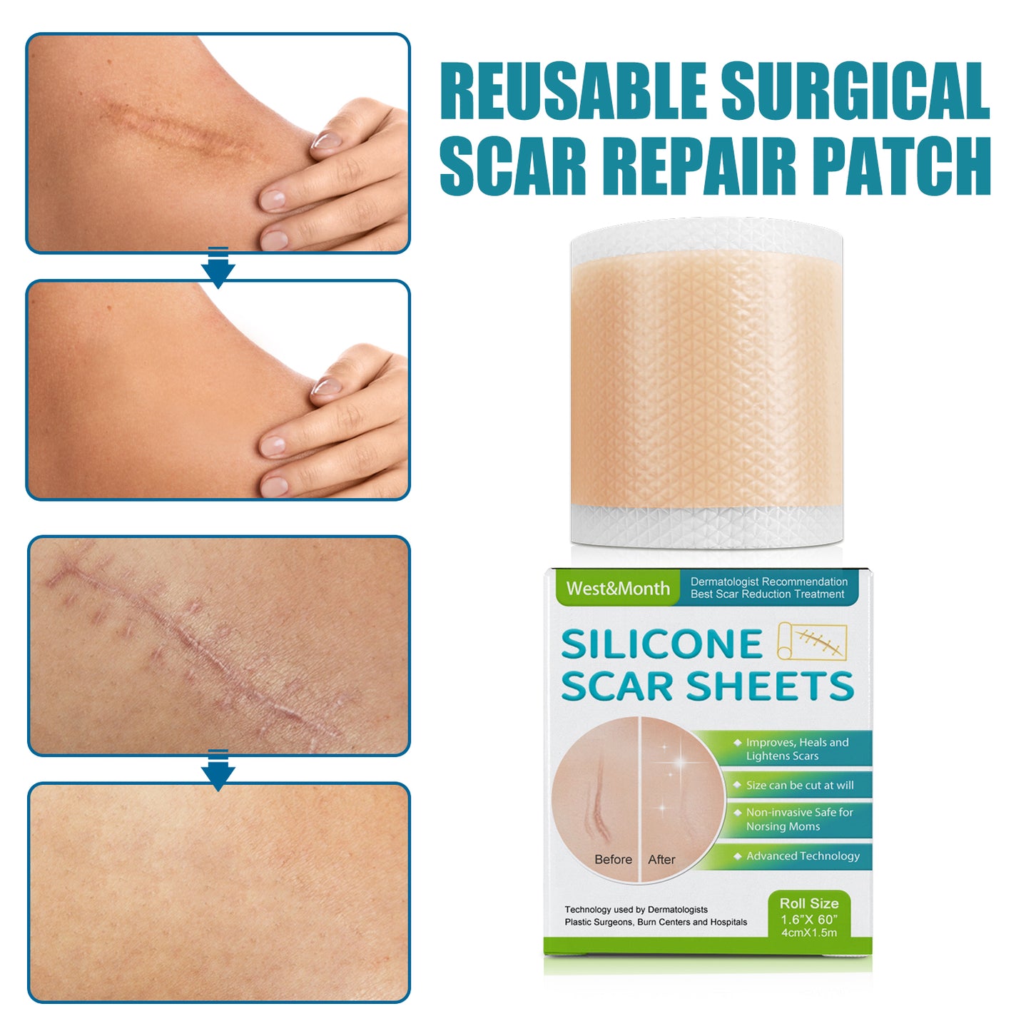 Reusable Silicone Scar Sheet Gel Patch