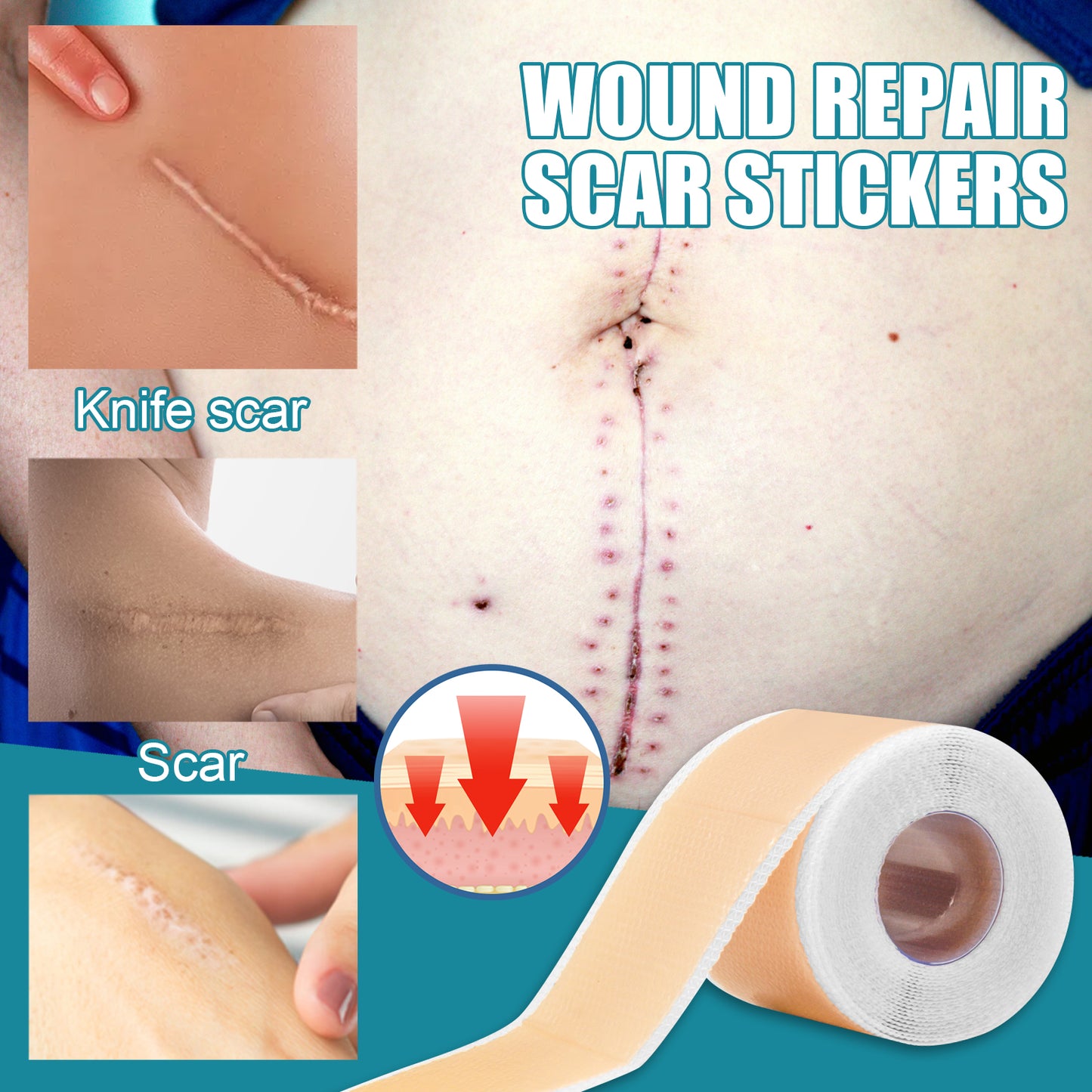 Reusable Silicone Scar Sheet Gel Patch